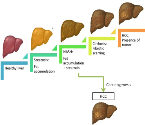 Managing NAFLD Through Gut-Liver Axis Modulation: Focus on Role of ...