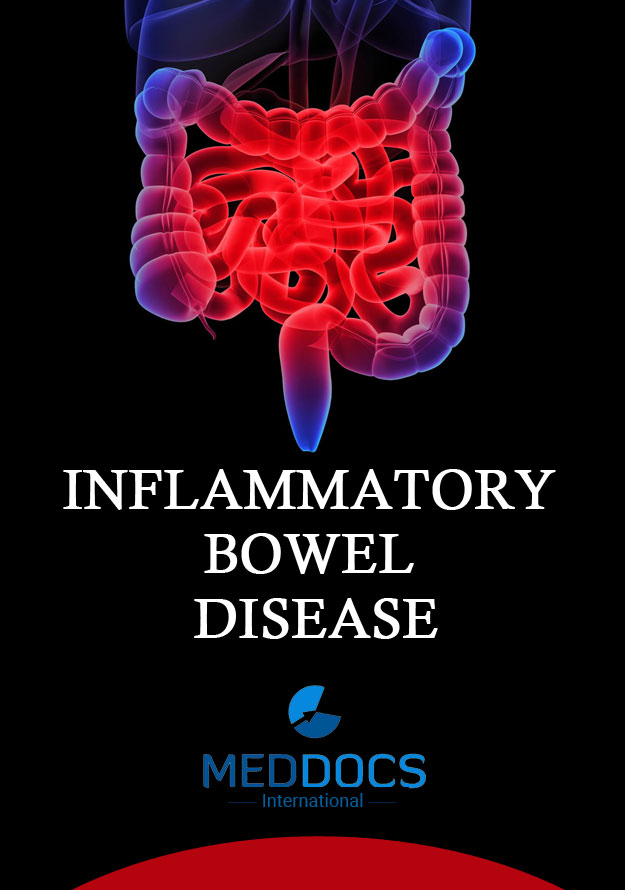 Inflammatory Bowel Disease