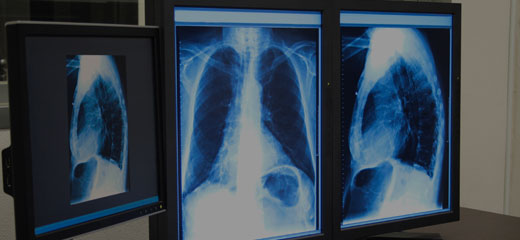Bulk-billed X-rays